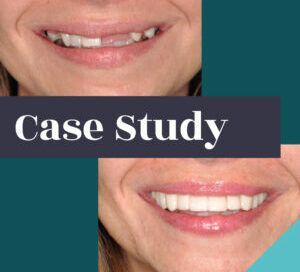 Dental Trauma Case study Feature x  x